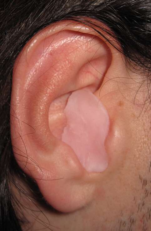 How To Put In Wax Ear Plugs